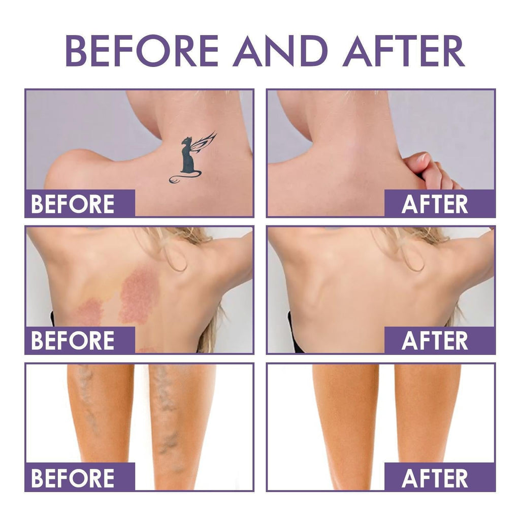 Body Coverage Perfector — Waterproof Body Makeup for Tattoos, Scars & Veins, 6 Buildable Shades, 74ml
